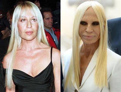 donatella versace soldi|donatella versace before and after surgery.